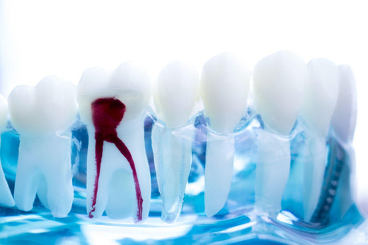 From Pain Relief to Potential Risks: What You Need to Know About Root Canals (And How To Avoid Them At All Costs))